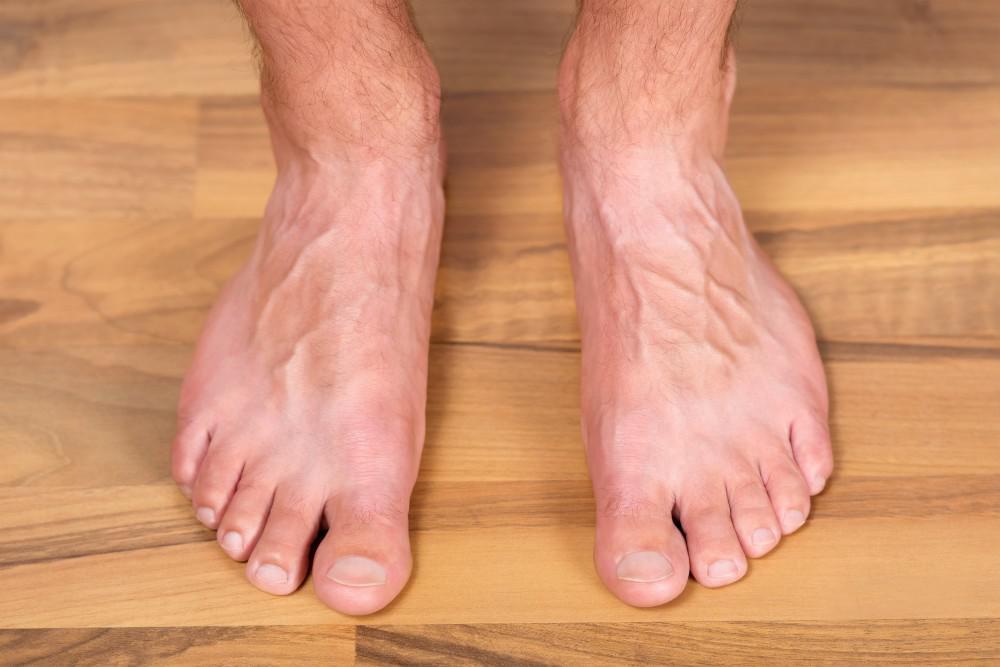 Top Tips for Protecting Your Feet This Summer When You Have Diabetes